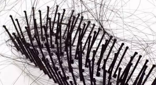 头发爱出油、掉发带白点怎么办？福建省泉州中科皮肤医院科普：做好这三点很关键