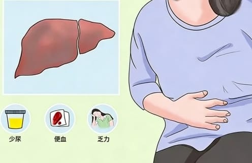 白癜风治疗为何要查肝肾功能？福建泉州中科皮肤医院为您解析其中关键！