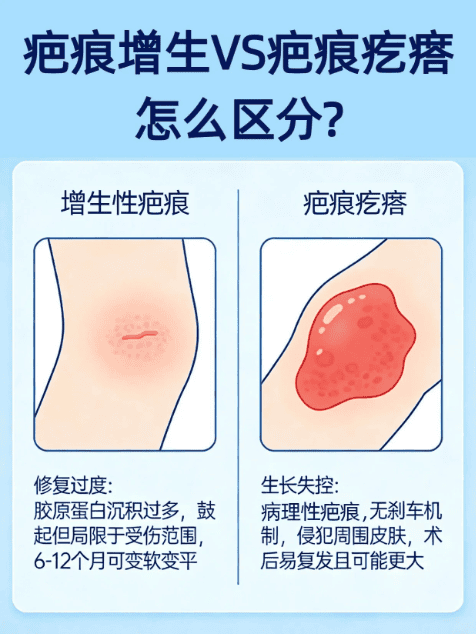 增生性疤痕和疤痕疙瘩如何区分？泉州中科疤痕医院专业指导，避免修复误区！