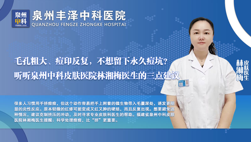 为什么你的痘痘越挤越多?福建泉州中科皮肤医院林湘梅医生给出科学解释! 为什么你的痘痘越挤越多?福建泉州中科皮肤医院林湘梅医生给出科学解释!